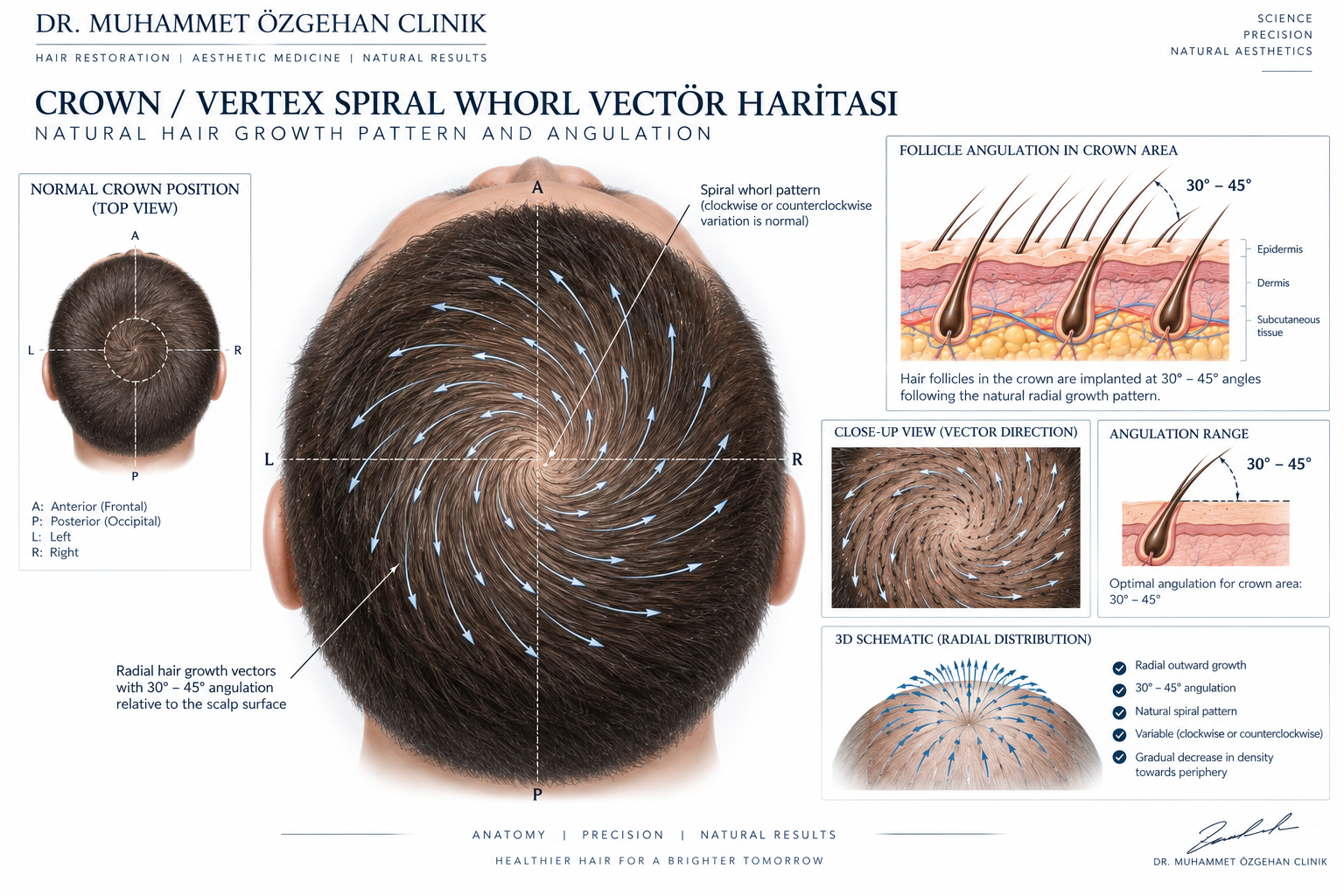 Crown vertex tepe bölgesi spiral whorl rotasyonu ve radyal mikro-kanal açılandırma